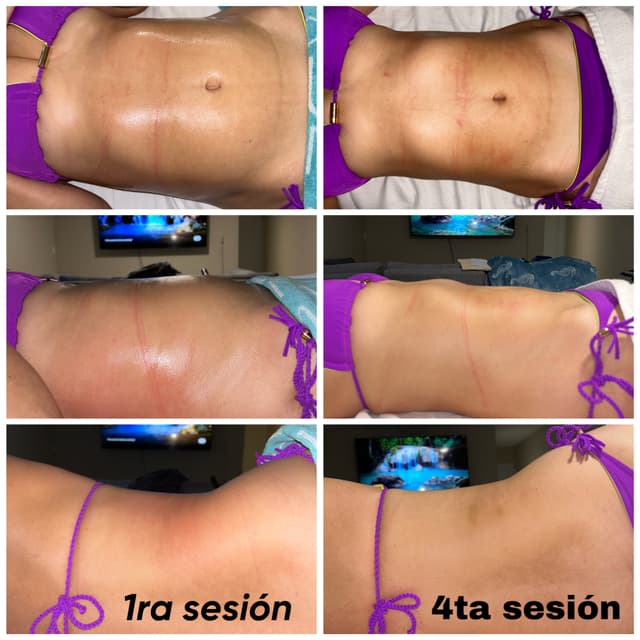 Esencia Corporal at Ungüento Massage Therapy in Killeen, TX